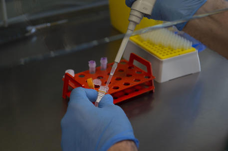 A researcher at work in the laboratory of Clinical Microbiology, Virology and Emergency Diagnostics of the Luigi Sacco hospital in Milan, Italy, 24 February 2020. Italian authorities announced on the day that there are over 200 confirmed cases of COVID-19 disease in the country, with at least five deaths. Precautionary measures and ordinances to tackle the spreading of the deadly virus included the closure of schools, gyms, museums and cinemas in the affected areas in northern Italy. ANDREA FASANI/ANSA